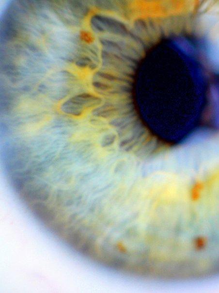 Beseda o irisdiagnostice